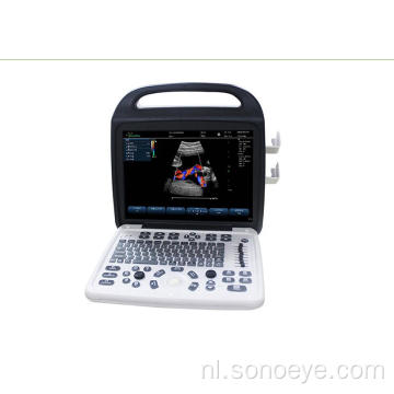 Kleur Doppler ultrasound systeem voor hostipal